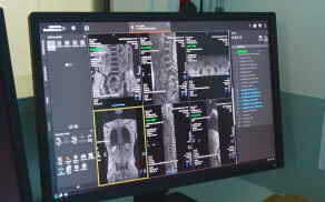 Więcej pacjentów, nowoczesny sprzęt i milionowe inwestycje - tak wygadał rok 2025 w pilskim Szpitalu